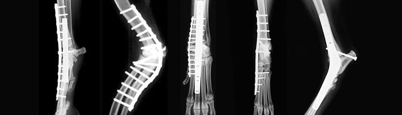 pg-hdr-arthrodesis