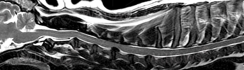 pg-hdr-cervical-disc-disease