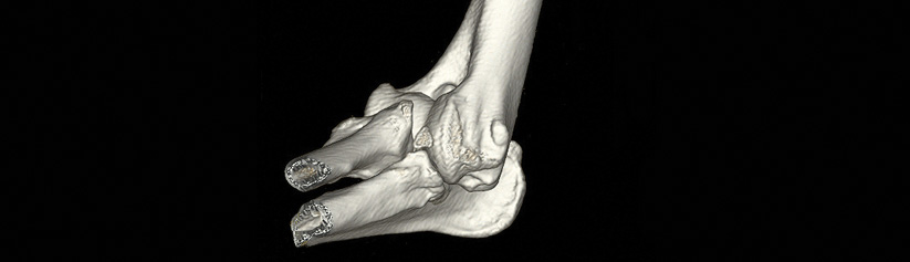 pg-hdr-elbow-dysplasia