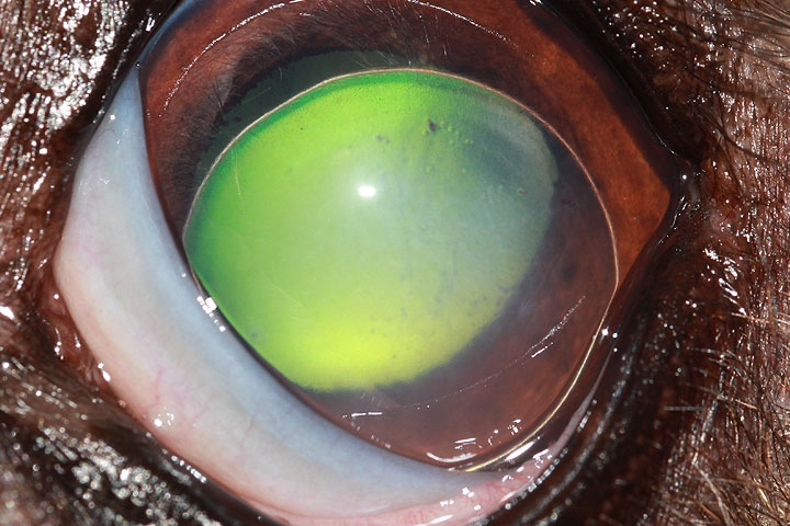 diseases-of-the-lens