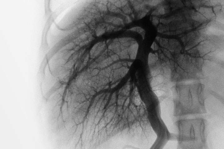 the-diagnosis-of-portosystemic-shunts